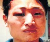 Three unidentified men assaulted , Chingmi Jojo, a software engineer from Manipur in Ashok Nagar recently.